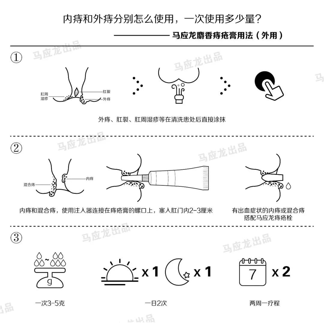 武汉马应龙肛肠医院正规靠谱 专业高效