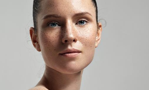 女人脸上长斑是什么原因 ？如何预防长斑？