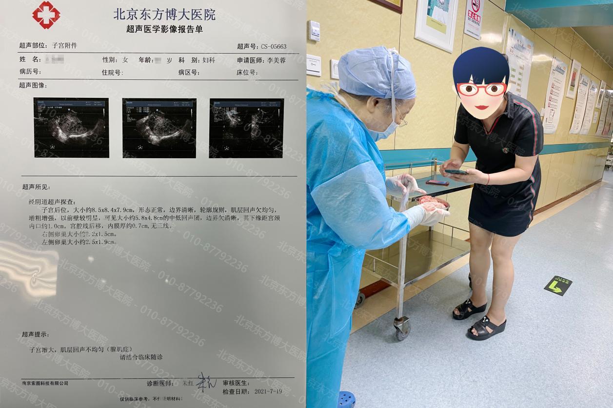 众多腺肌症患者在北京东方博大医院有效治疗