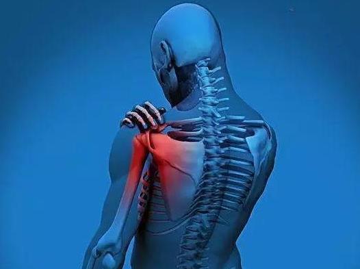 肩周炎的症状 肩周炎是怎么形成的？