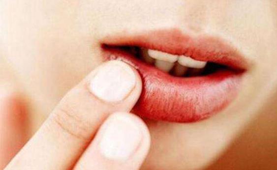 那么嘴唇干燥是什么原因？预防嘴唇干裂有哪些方法？