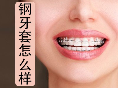 天津矫正牙齿的优缺点-矫正牙齿利与弊