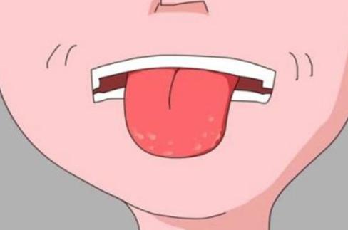 舌苔厚是什么原因？如何避免舌苔厚？