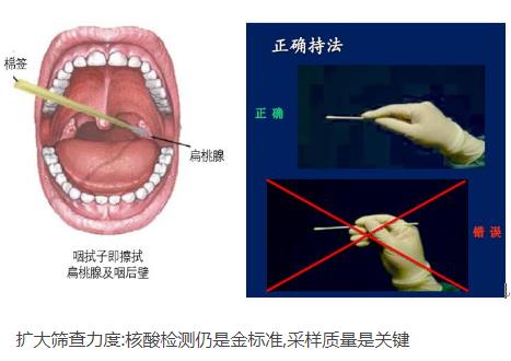 核酸检测新冠病毒的常用手段：口腔拭子、鼻腔拭子检测图解