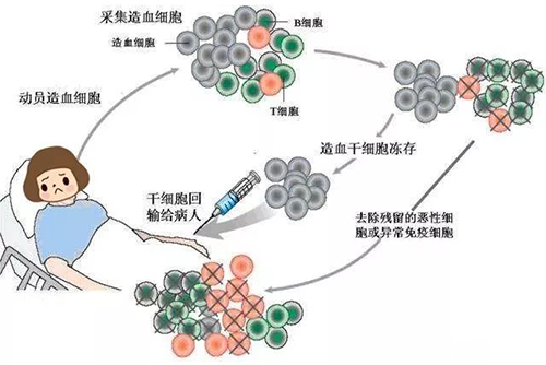 济南血液病医院：治疗淋巴瘤自体造血干细胞移植效果咋样？