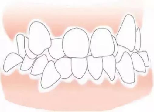 牙齿酸软是怎么回事？老人牙齿酸软怎么办？