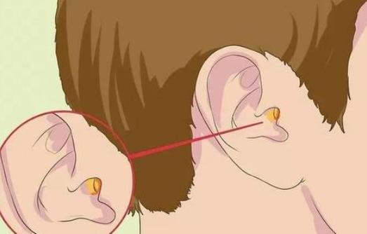 耳屎对耳朵有什么好处？常给孩子掏耳朵有什么危害？