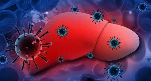 病毒性肝炎的症状 病毒性肝炎如何治疗