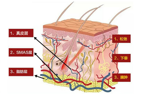 什么是赫本线？联合丽格向淑英抗衰新理念：45°赫本线紧致术