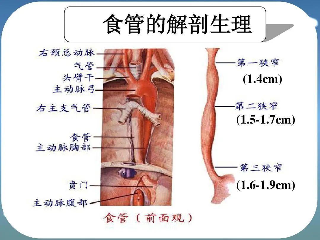 广州复大肿瘤医院案例998：为食管癌患者打开“生命通道”