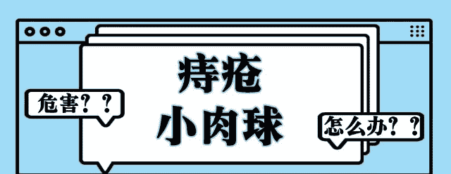 天津欧亚肛肠医院解答：外痔疮肉球摸着别扭，发作起来疼痛，怎么消除？