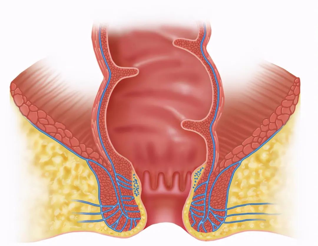 贵阳东大肛肠医院：屁屁这么擦才干净，很多人第 1 步就做错了！