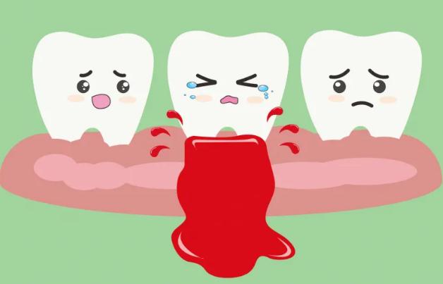 牙龈出血是什么原因？牙龈出血吃什么水果？