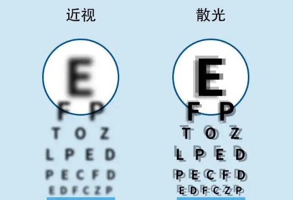 散光的症状有哪些？散光可以戴隐形眼镜吗？