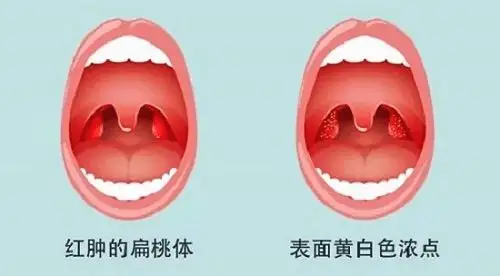 成都耳鼻喉专科排名最好医院 成都民生耳鼻喉医院好吗 国家三级医院