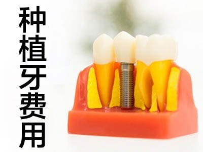 种牙收费 天津现在种植牙一颗大概要多少钱