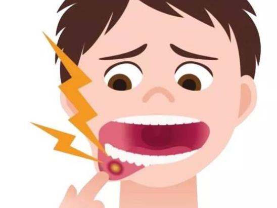 口腔溃疡怎么办 消除病因增强体质全身局部治疗结合