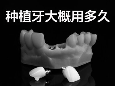  种牙的寿命有多长 天津种植牙后的牙齿能用多久