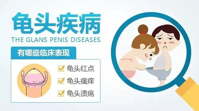  北京紫荆医院医生专业吗：为什么包皮龟头炎有异味。