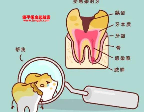 牙周炎能自愈吗 局部用药定期治疗刷牙