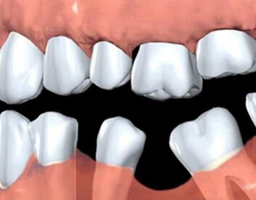 牙齿松动是什么原因 牙周炎乳牙咬合发育不良创伤