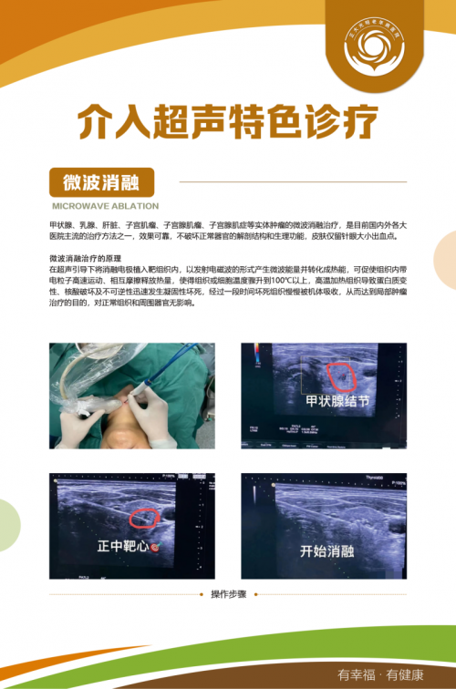 4月22日国际知名专家来潍坊正大光明老年病医院会诊并开展甲状腺微波消融术